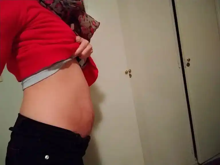 Tiene una de las enfermedades más raras del mundo, pasó por 7 operaciones y necesita ayuda