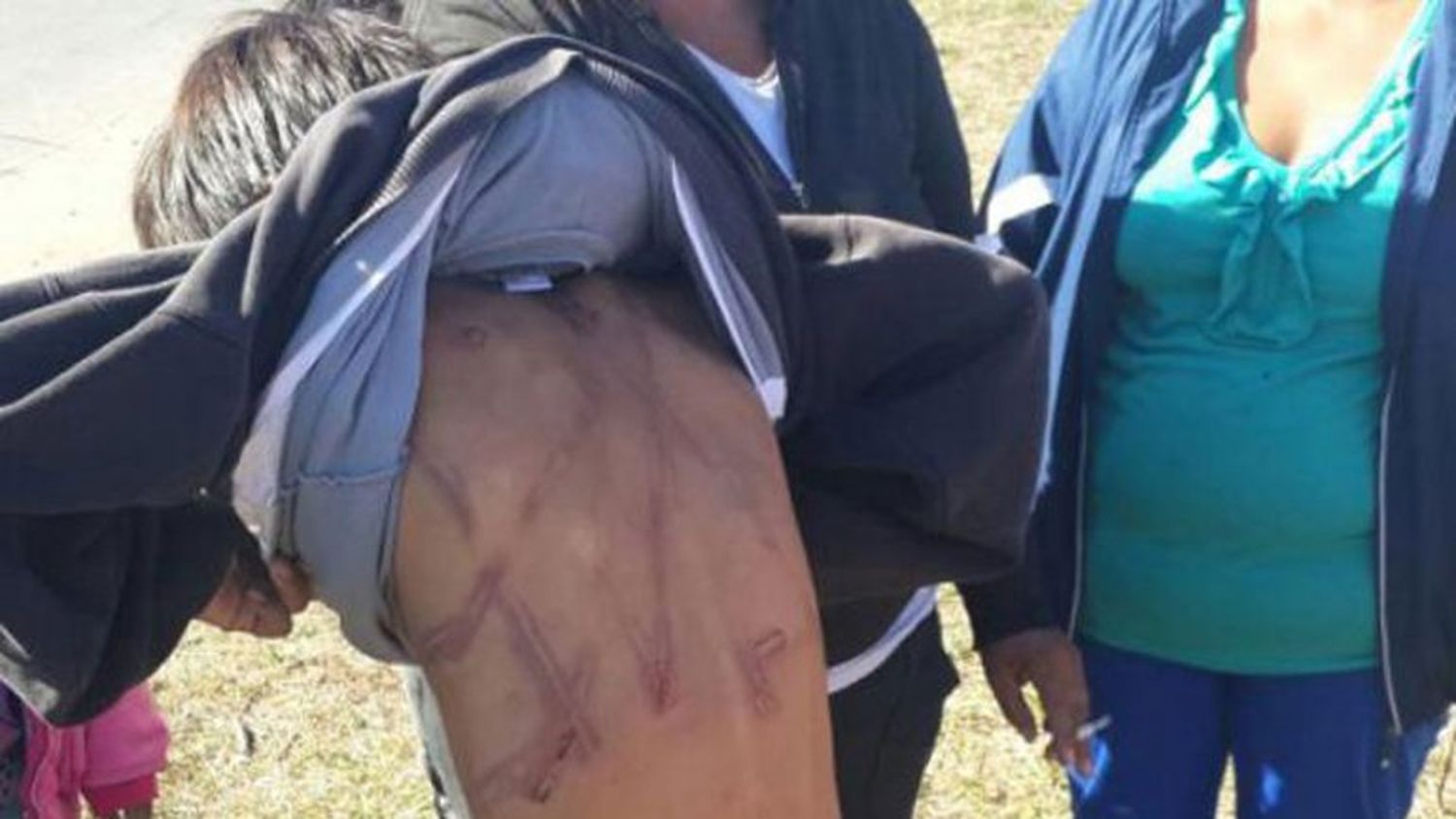 Lastimó a sus hijos porque perdieron la tarjeta del plan social