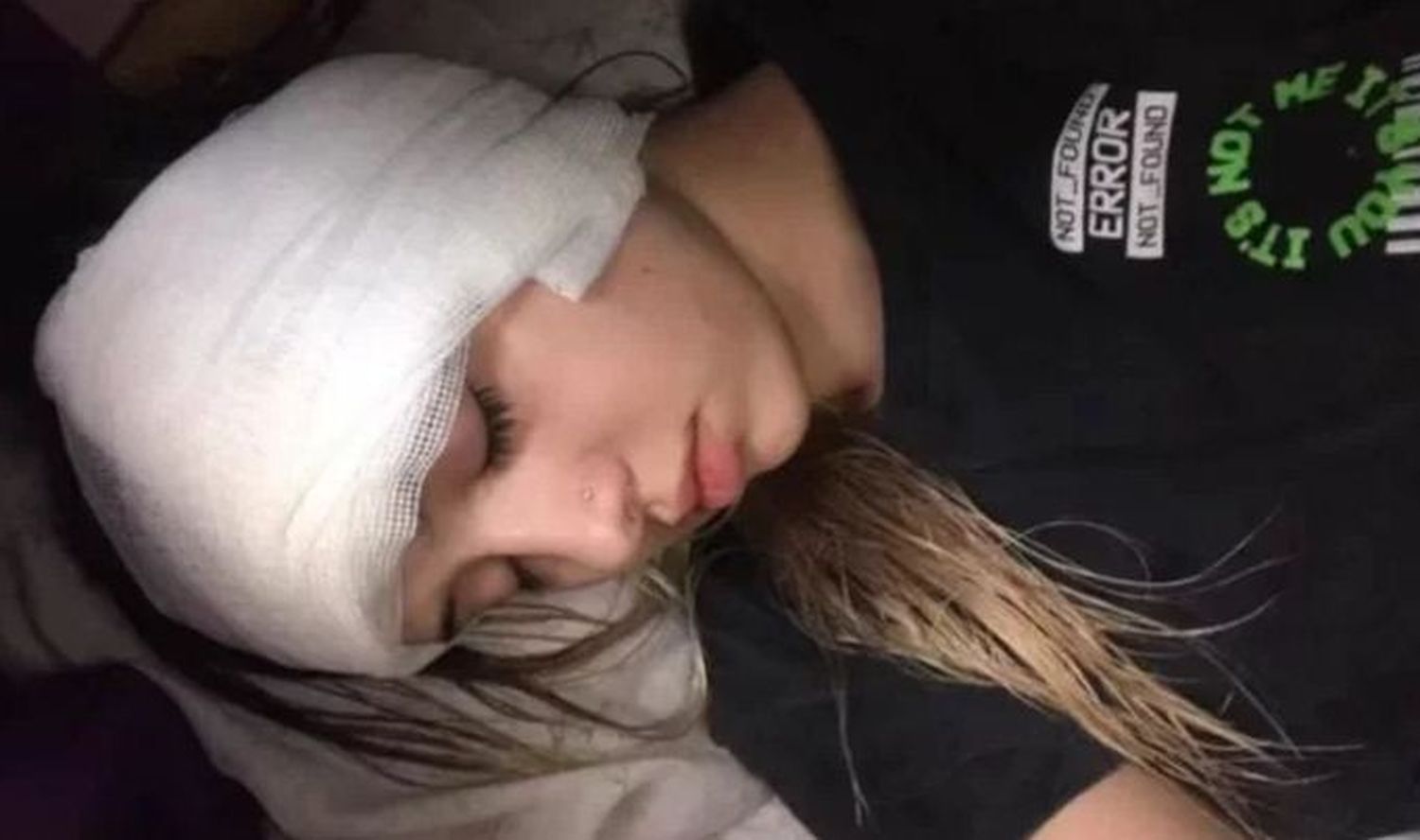Brutal ataque a una moza: recibió 20 puntos, deberá ser operada y quedó sorda de un oído