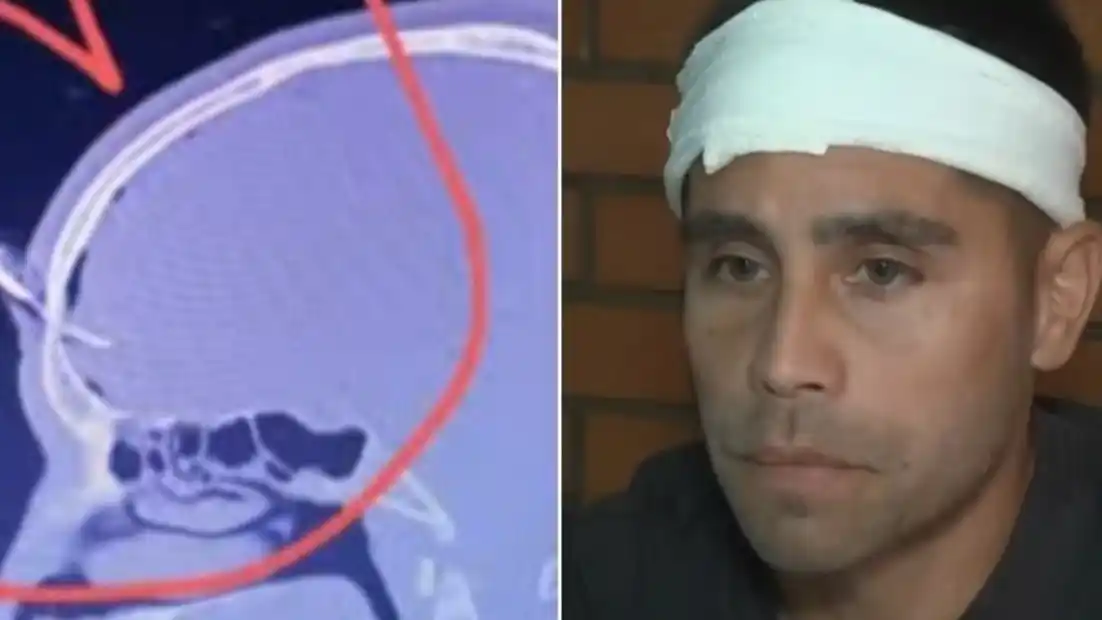 Jonathan Smith relató el momento en el que un hombre le clavó una llave de auto en la cabeza.