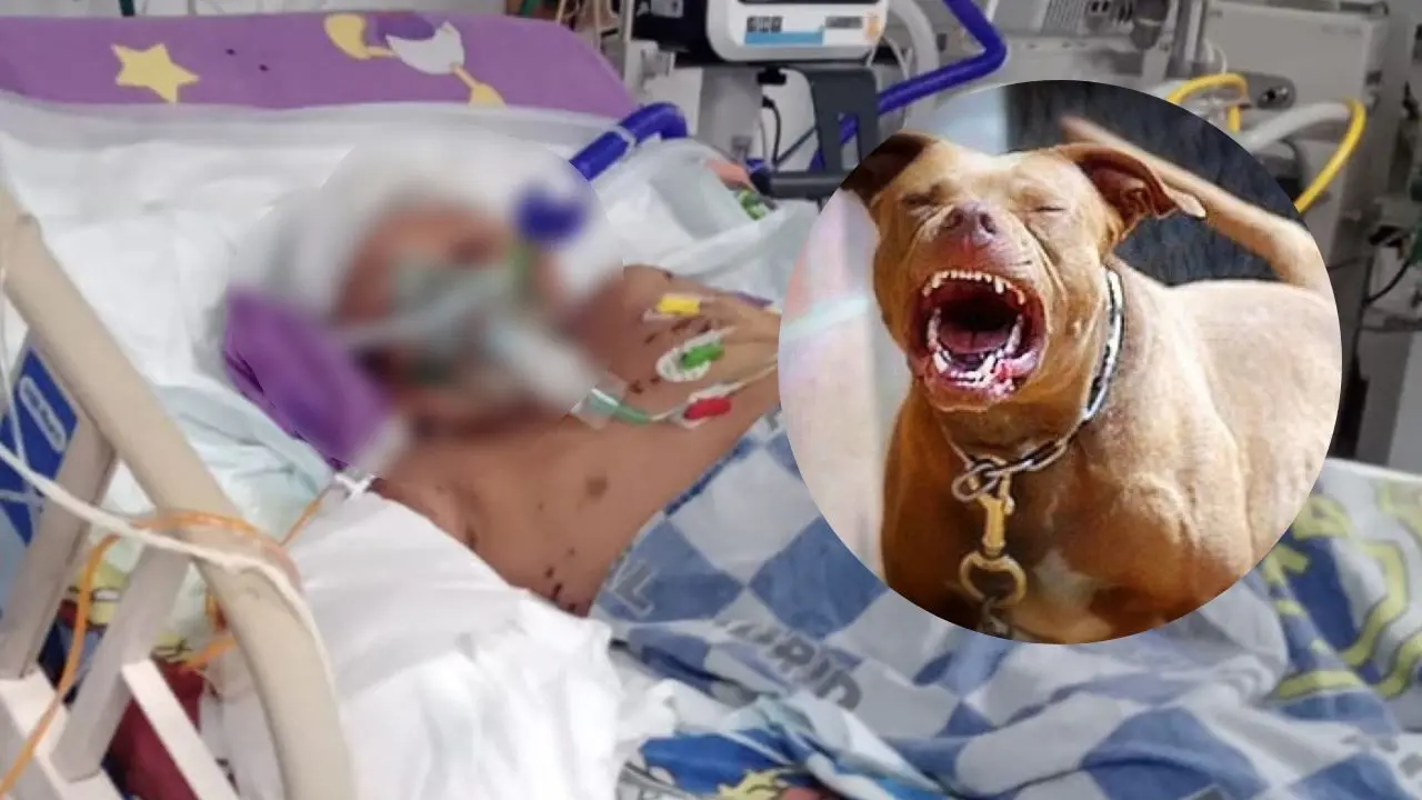 Niño fue atacado varias veces por dos perros callejeros en Ciudad Bolívar