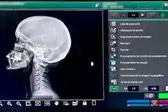 Avanza la digitalización de servicios de diagnóstico por imágenes