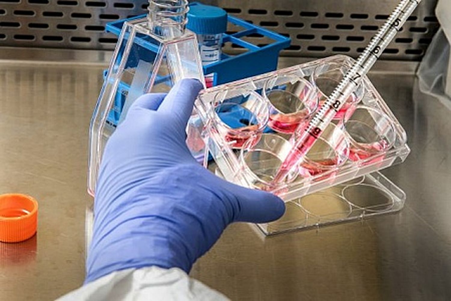 ¿Positivo para coronavirus? Inmunidad dura cuatro meses