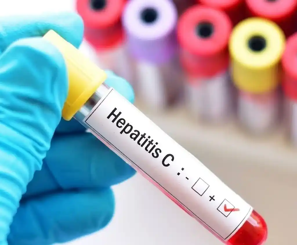 Se estima que entre 6 y 7 de cada 10 personas que tienen el virus lo desconocen.