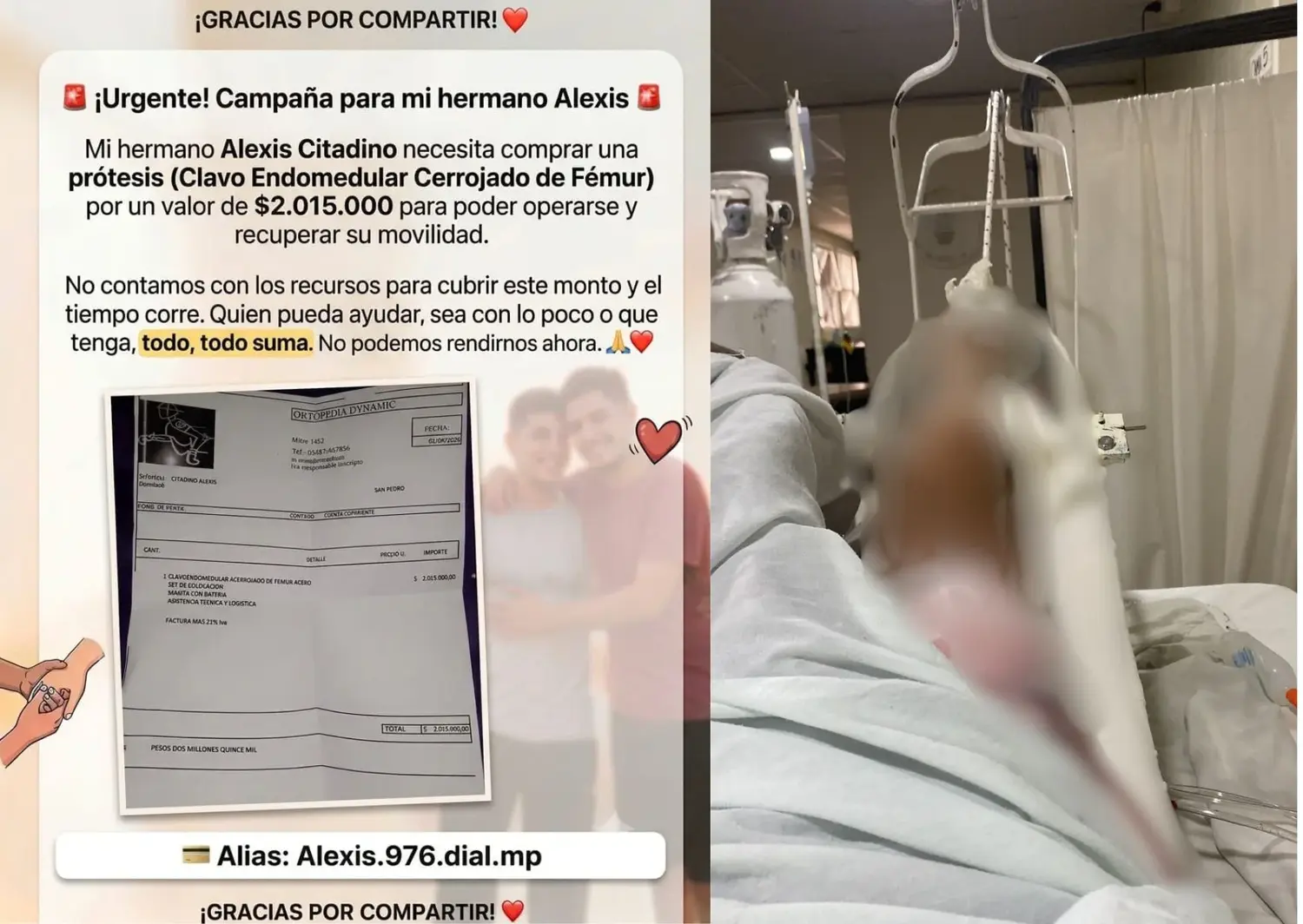Pedido de colaboración para Alexis: sufrió un accidente de tránsito y necesita una prótesis
