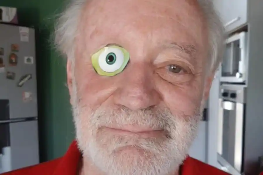 Es tuerto y burló los datos biométricos de la app Mi Argentina al dibujarse un ojo en su parche