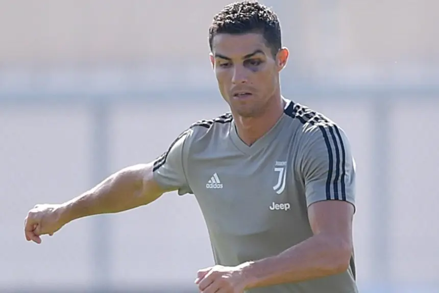 ¿Qué le pasó a Cristiano en el ojo?