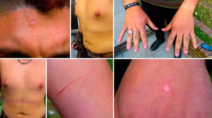 Miramar: Hay 7 policías imputados por secuestrar y torturar a un joven homosexual