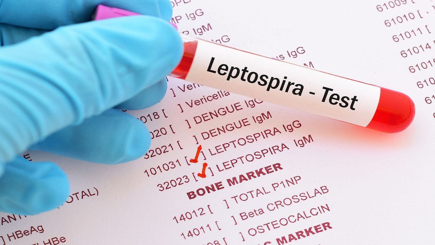 Murió un hombre por leptospirosis en Entre Ríos