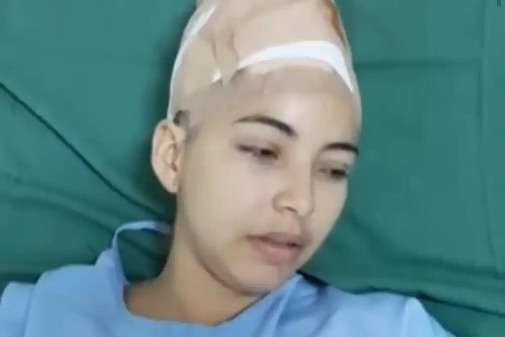 Horror: le arrancó el cuero cabelludo a su novia para “que nadie la mire”