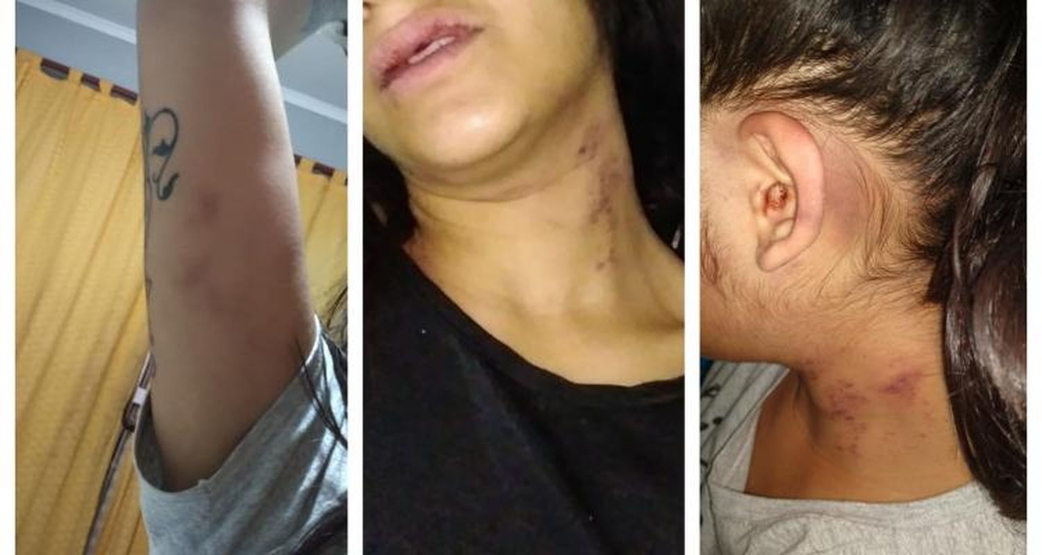 Liberaron a un joven que estaba acusado de “intento de femicidio” y cambiaron la carátula a “lesiones leves”
