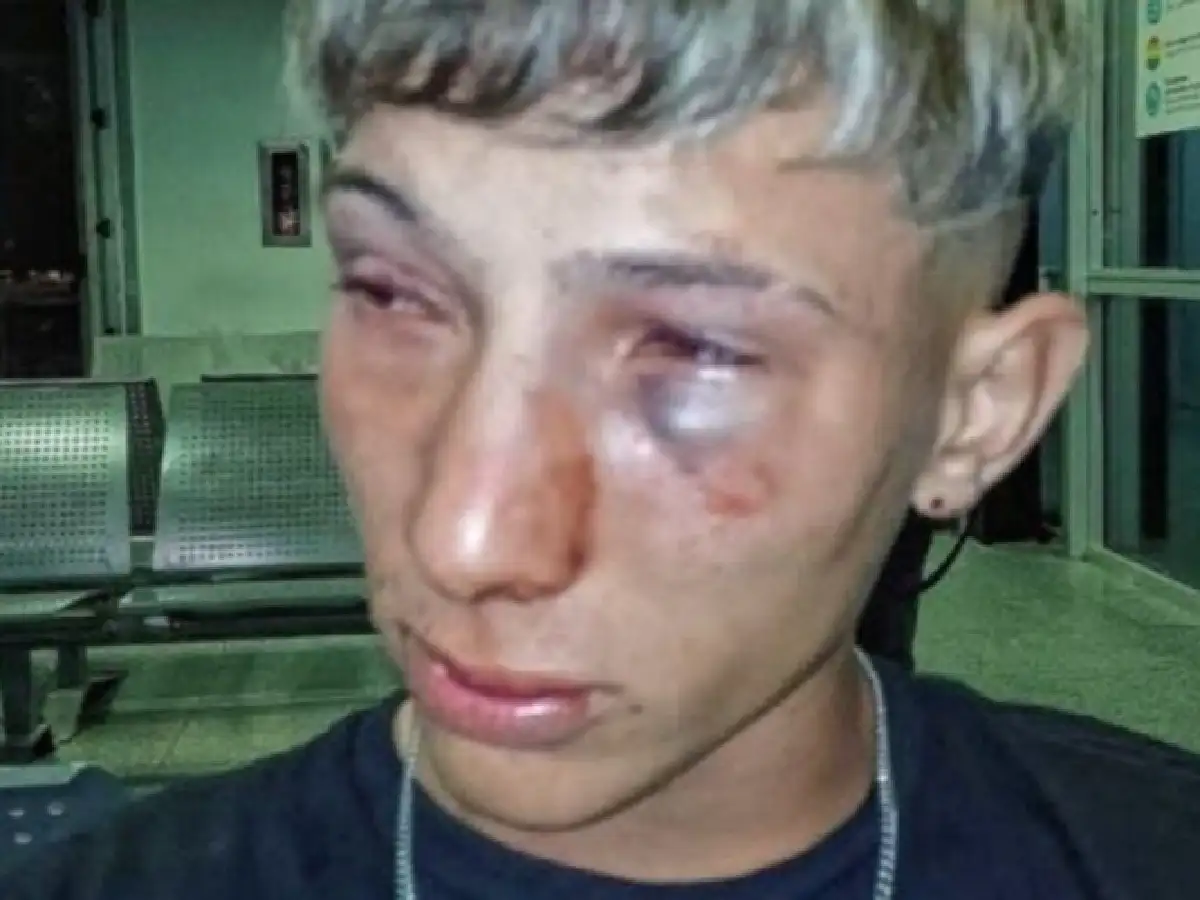 Violenta agresión en un boliche de Santa Fe: un grupo de patovicas le dio una brutal golpiza a un joven