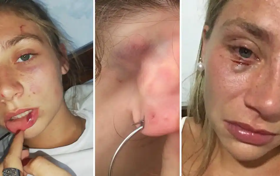 Descarnado relato en primera persona: Bernarda contó el infierno que vivió con su ex