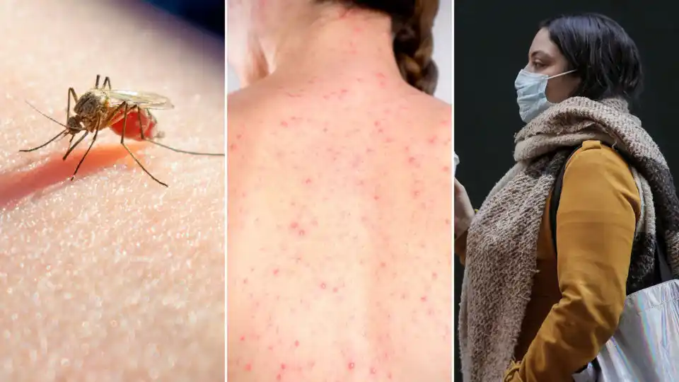 Más que el Coronavirus, crece el dengue, el sarampión y el hantavirus en Provincia de Buenos Aires