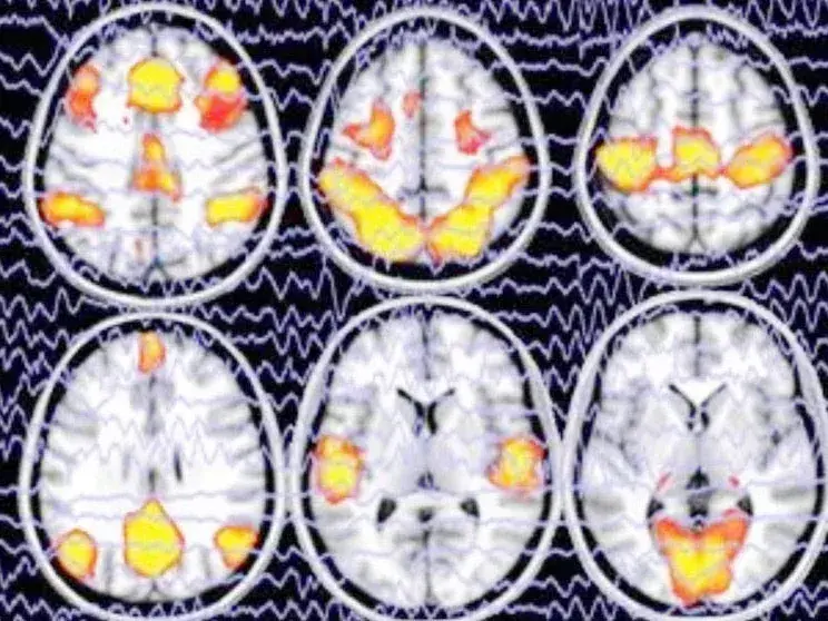 Crean una IA de “lectura de mente”: puede reconstruir lo que estás mirando a partir de un escáner cerebral