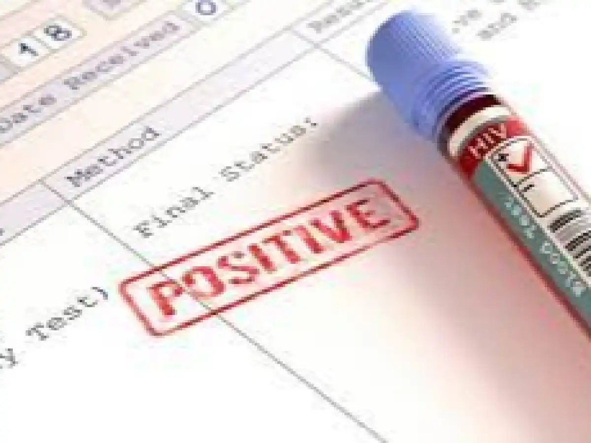 Una clínica privada deberá indemnizar a un joven al que le rechazaron el trabajo por ser VIH positivo