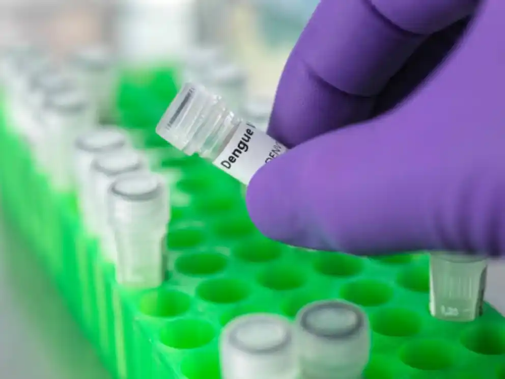 Conicet desarrolla el primer test de origen nacional para el diagnóstico del dengue