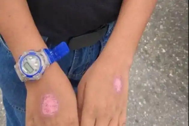 Por quemarle las manos a su hijo detienen a exfuncionaria de la PNB