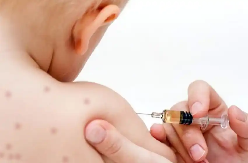 Tras dos años sin la enfermedad, Argentina registró el primer caso de sarampión