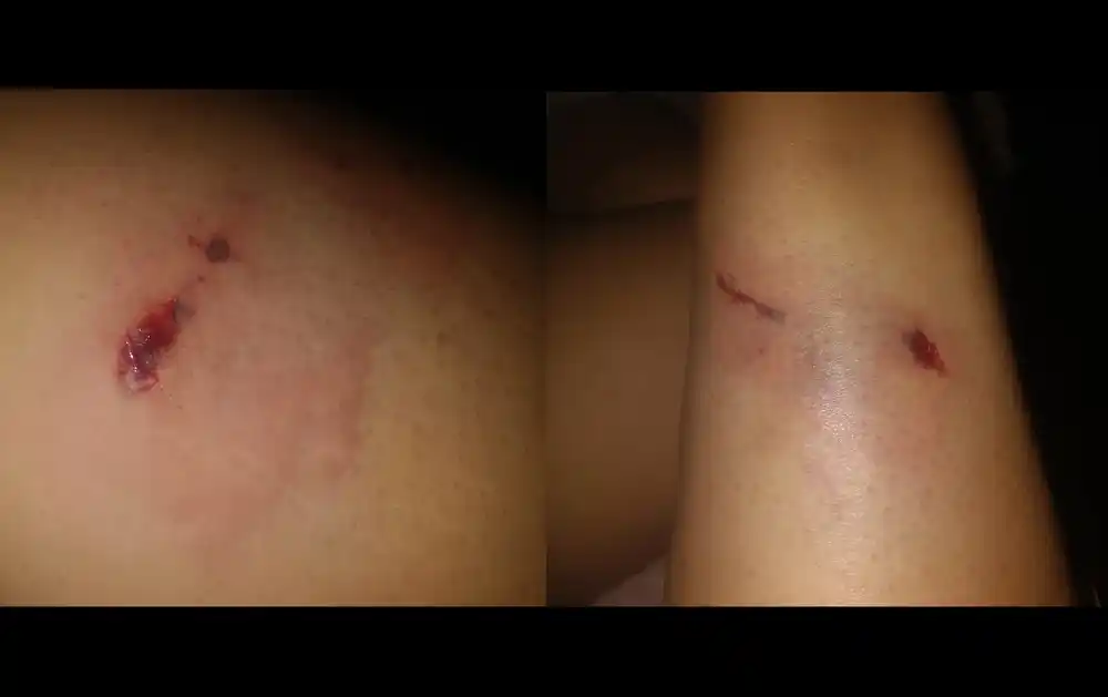 Perros mordieron a una motociclista en Maestro Reyna e Yrigoyen