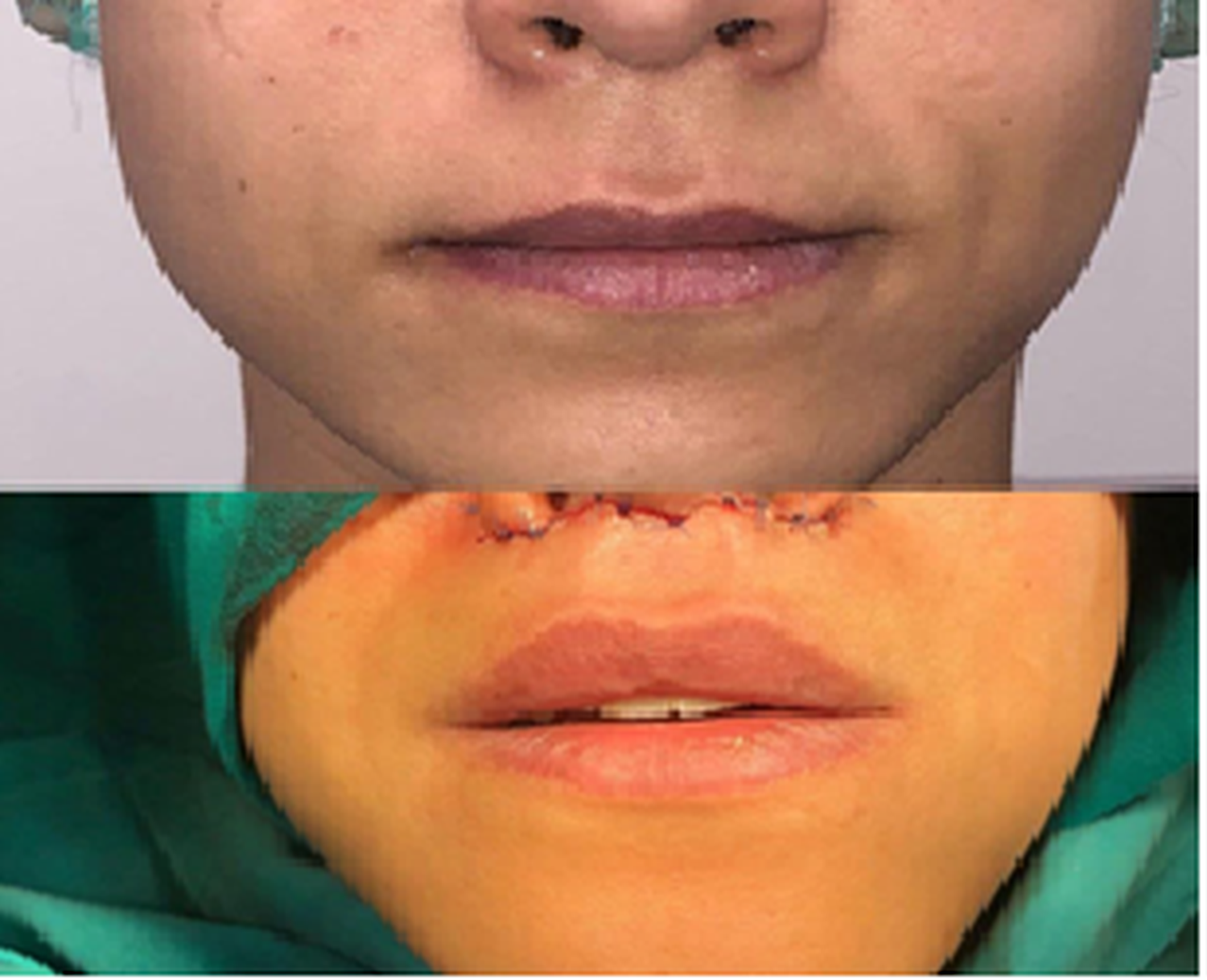 labios