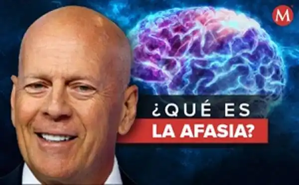Estas cinco enfermedades causan afasia,  la enfermedad de Bruce Willis