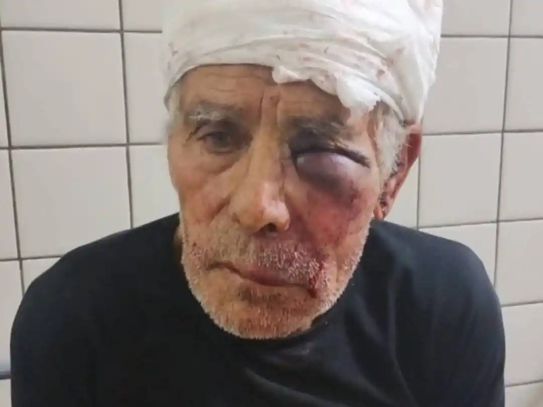 El fiscal Walter Martínez Soto explicó que la caída sufrida fue como consecuencia del desequilibrio que le produjo las lesiones producidas