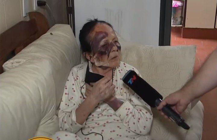 Inseguridad salvaje en San Martín: Desfiguraron a una jubilada para robarle pintura y la tarjeta SUBE