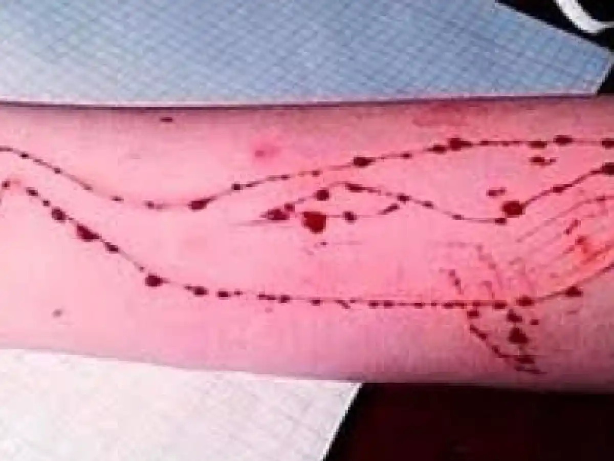 Un juez insta a los medios a advertir de la "Ballena Azul"