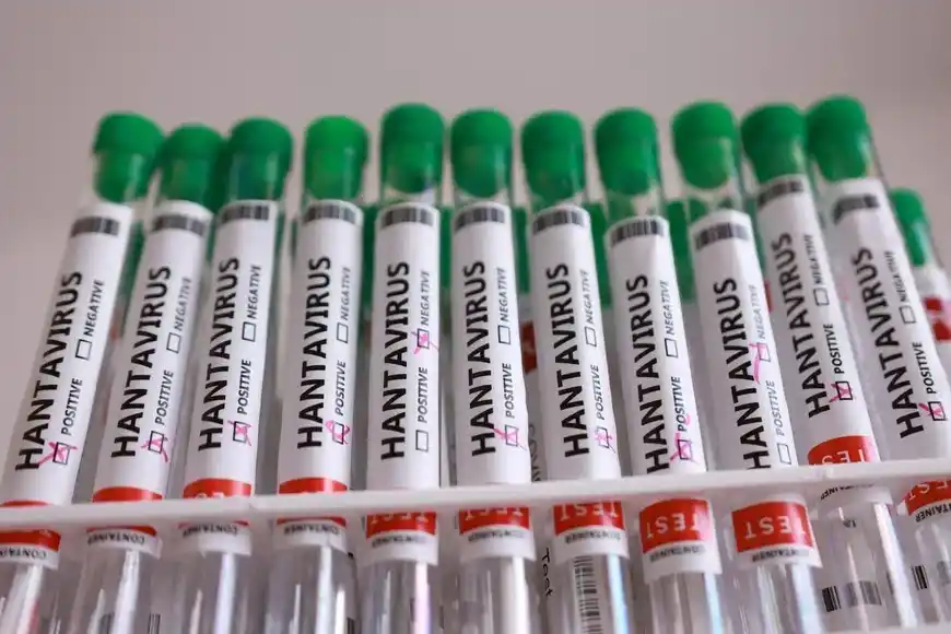 hantavirus