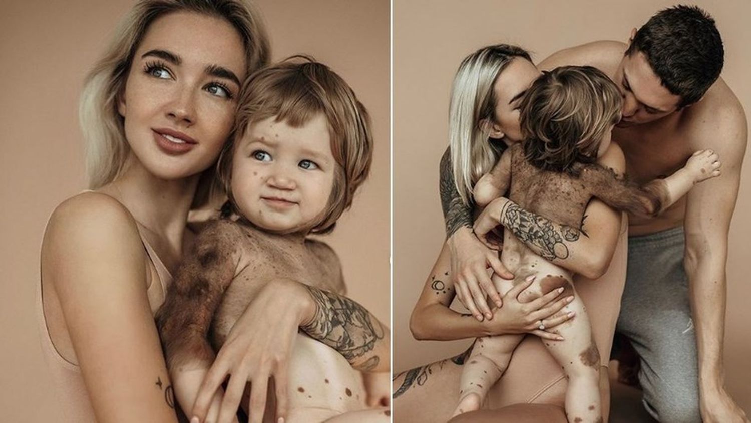 Influencer mostró en redes sociales la extraña enfermedad de su pequeño hijo