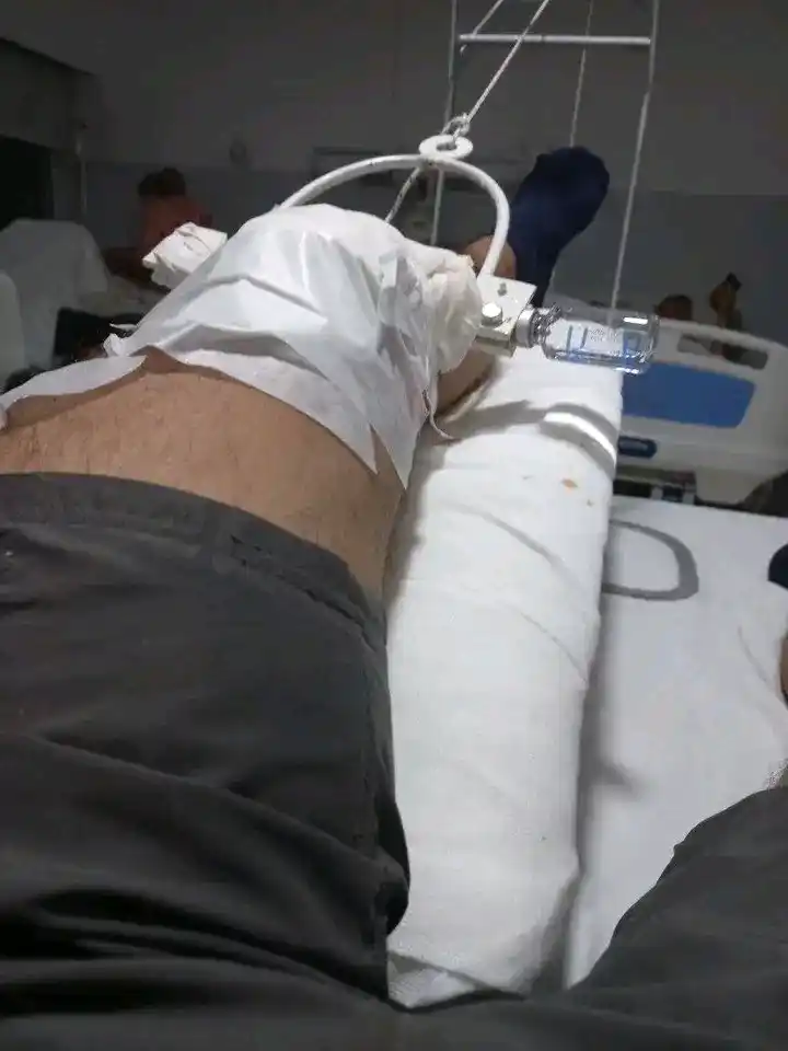 Jóven con fráctura de fémur