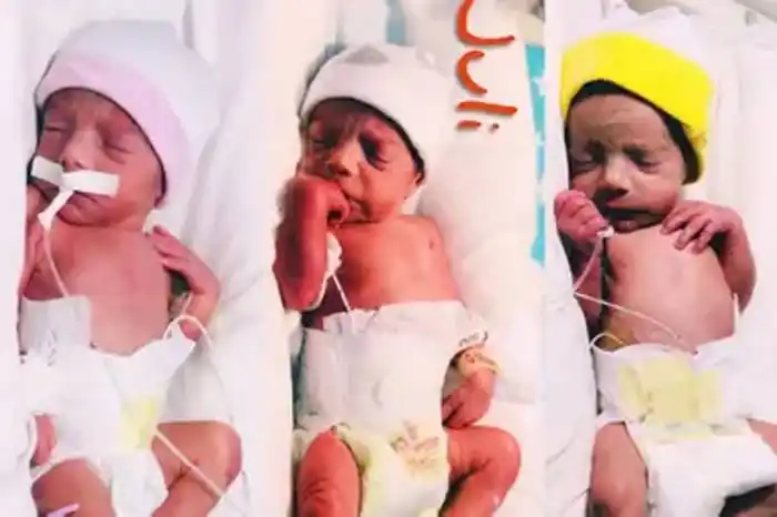 Nacieron las trigemelas, un caso que se da cada 200 millones de embarazos