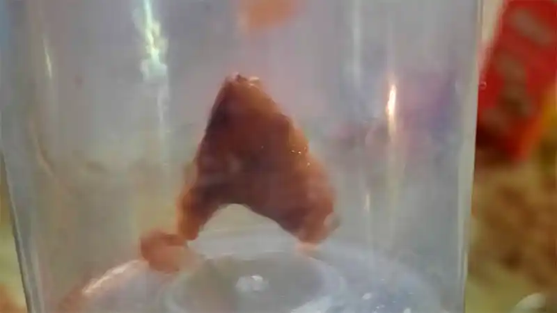 Un empresario entrerriano está grave porque una espina de pescado le perforó la tráquea