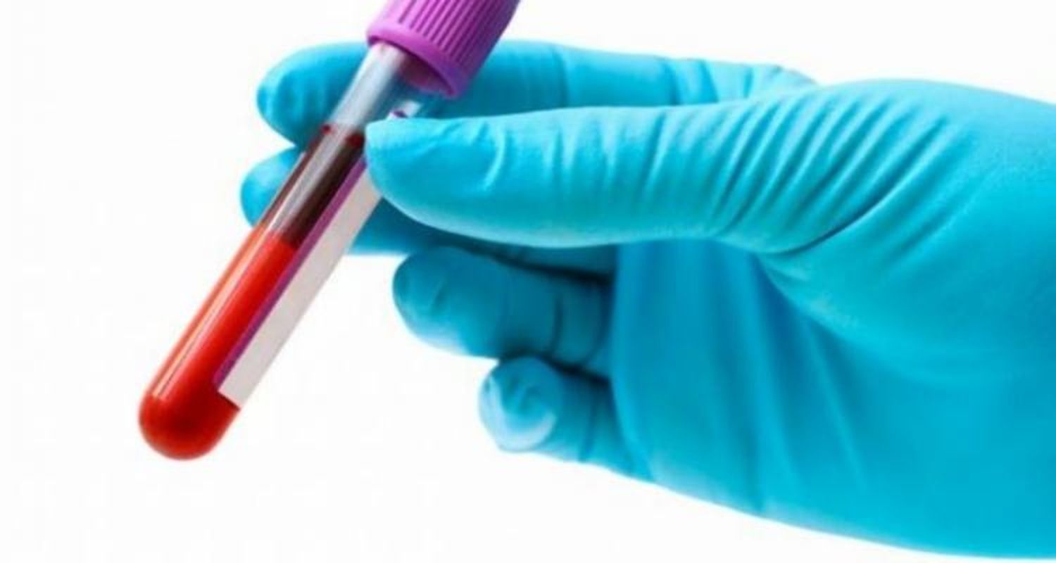 Reactivos contra el HIV