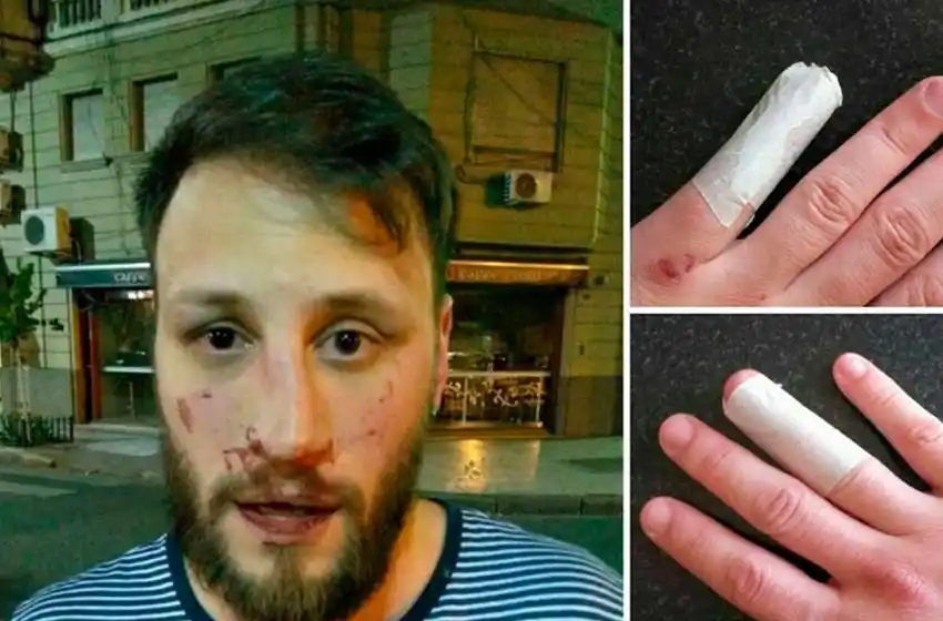 Agreden a un joven en la fiesta de la facultad de Derecho