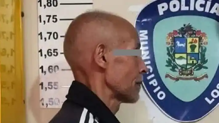 A YARE III: imputan al coronel que dio brutal golpiza a su pareja