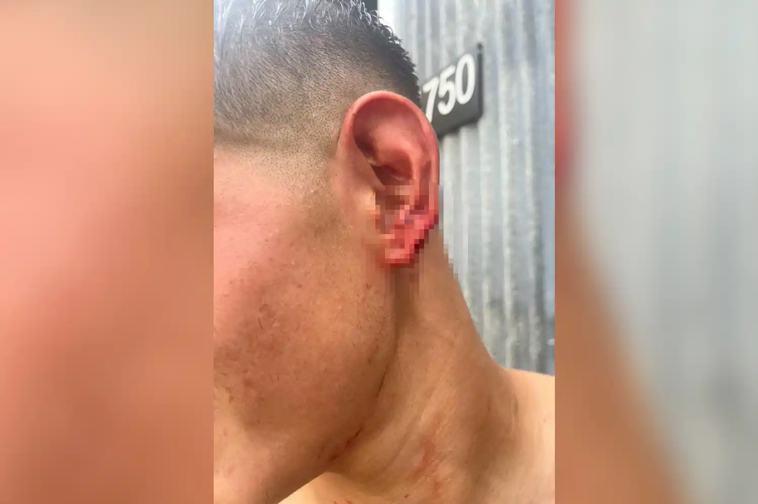 oreja mordida chipi gandin