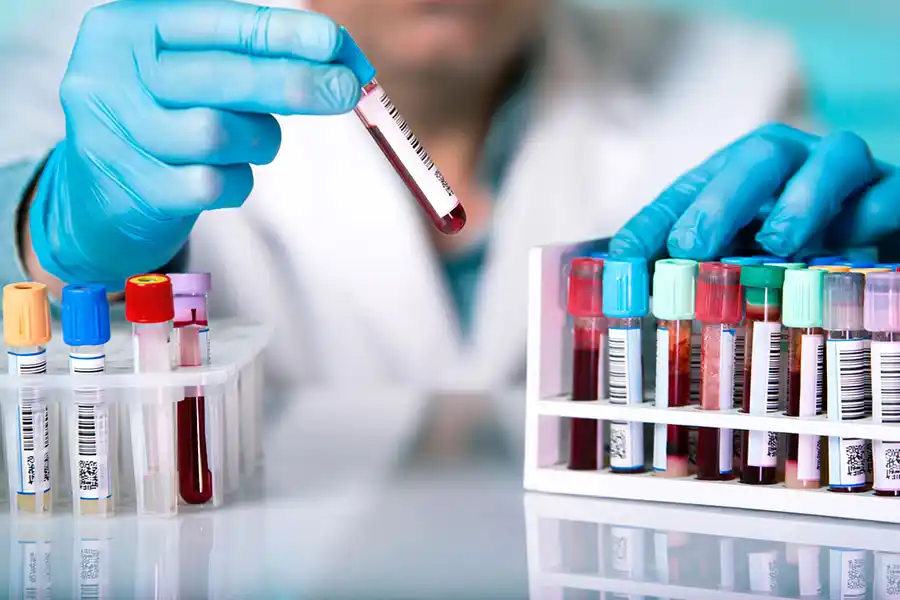 Suspenderían servicios de análisis clínicos en laboratorios de todo el país