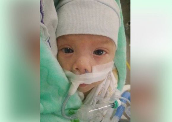Piden cadena de oración por Tahiel: tiene 3 meses y padece una malformación en su cerebro