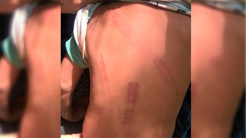 Dos niños de 2 y 4 años fueron hospitalizados por la golpiza de su padrastro