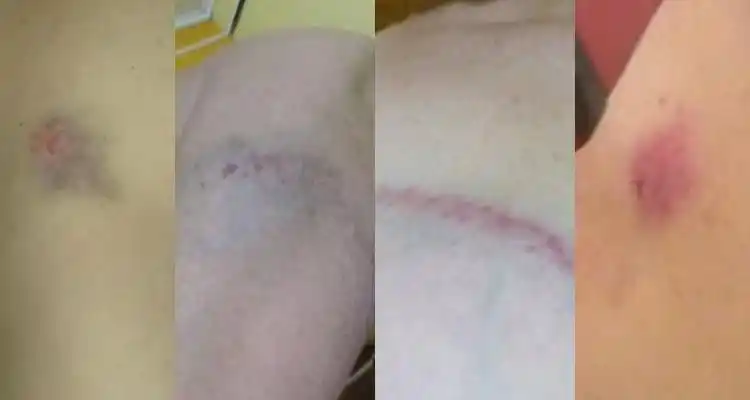 El drama de una mujer que denunció a su expareja por haberle pegado “con un palo” y espera una “restricción perimetral”