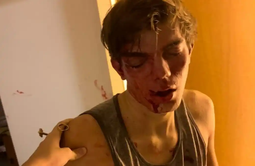 Robo salvaje a dos jovenes en un edificio céntrico