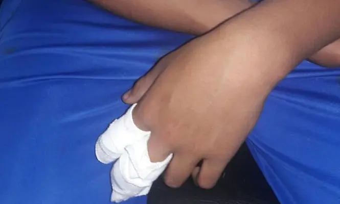 Lucas presenta heridas en una de sus manos y un hematoma en la cabeza. 