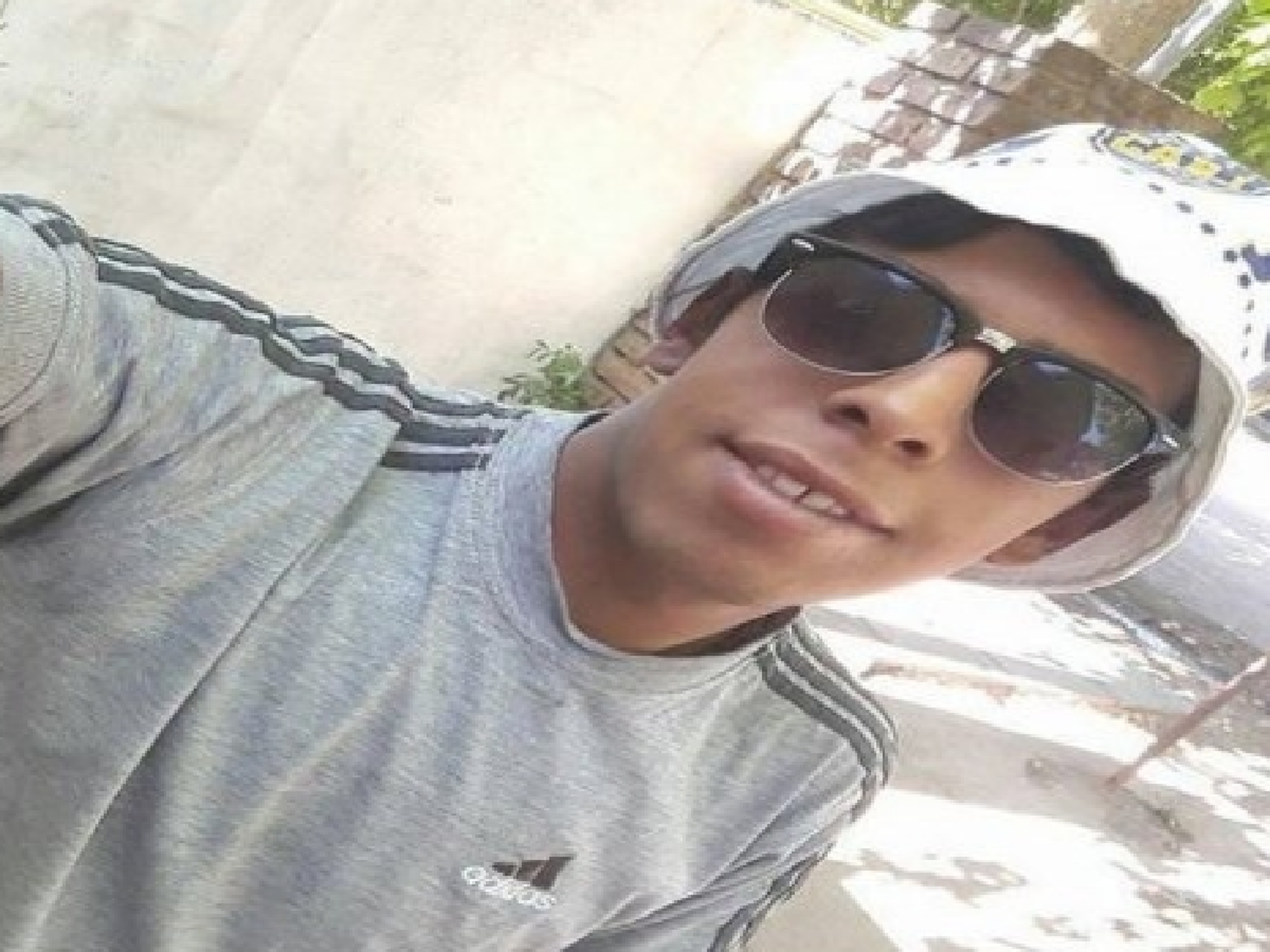 Murió el joven que sufrió graves quemaduras al realizar una conexión de luz