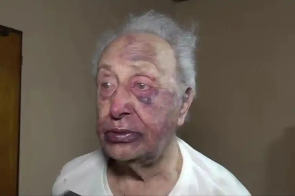 El hombre que fue golpeado en su propia casa.