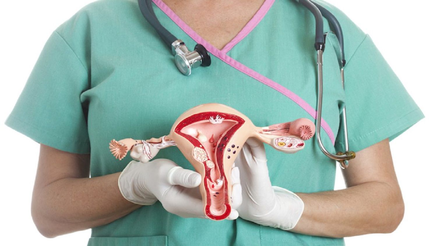 MIOMAS ¿Qué son y cómo se tratan?