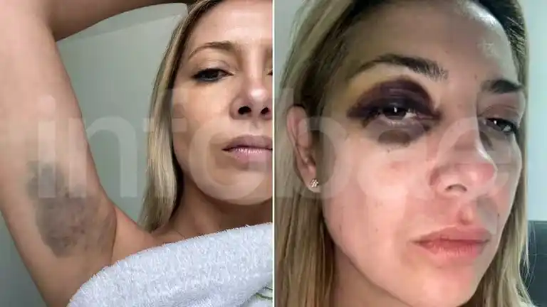Las fotos de Fabiola Yañez que están en la causa judicial