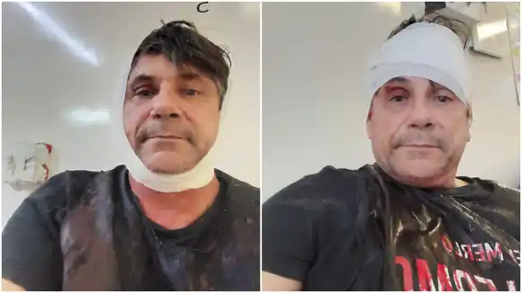 Denuncian que le dieron un culatazo en la cabeza a un candidato a concejal mientras pegaba afiches en Merlo