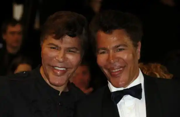 Gemelos franceses, estrellas de TV, fallecen de COVID sucesivamente